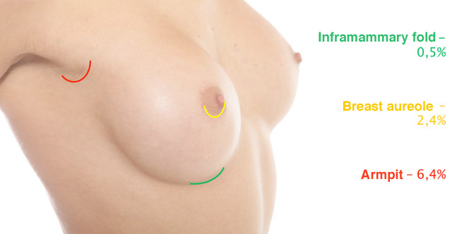 large pores on breasts